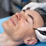 Мезотерапия кожи головы: инъекционная процедура для укрепления волос